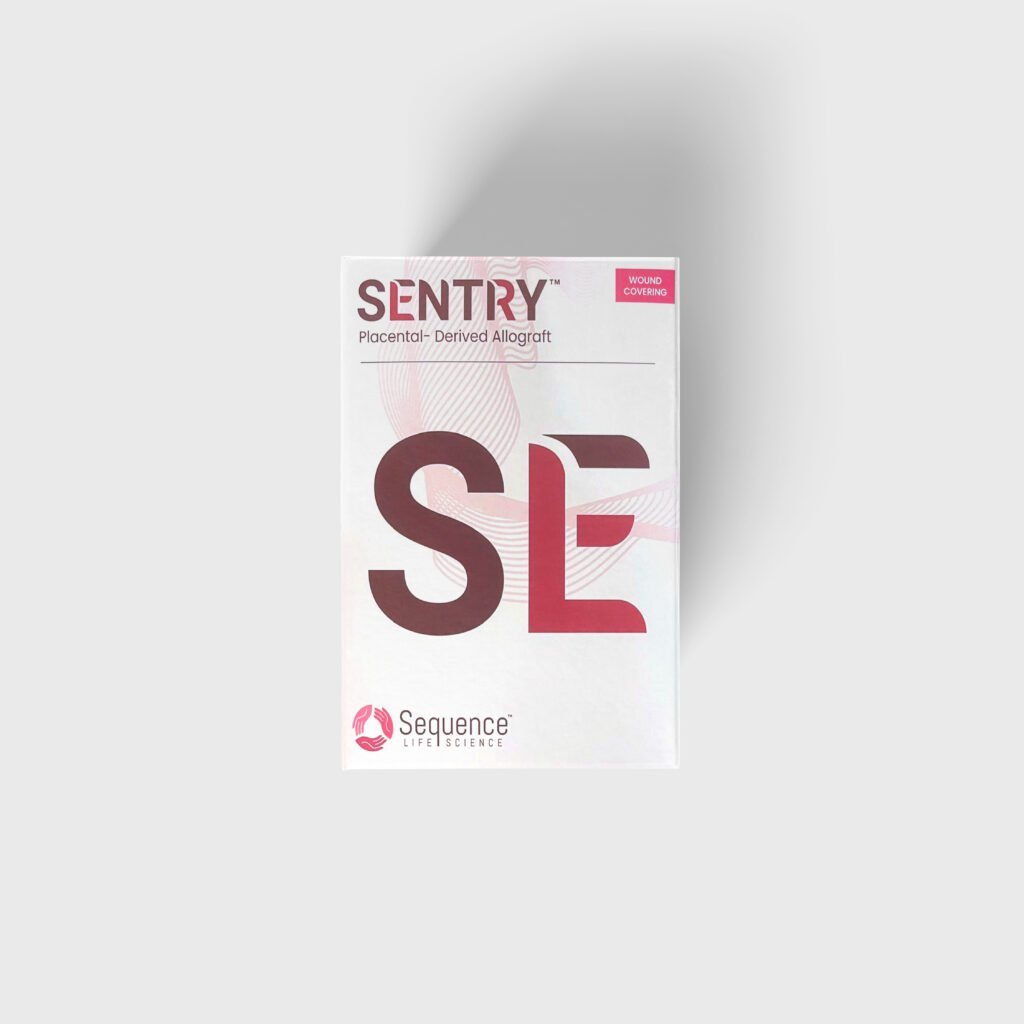 Sentry (Q4348)